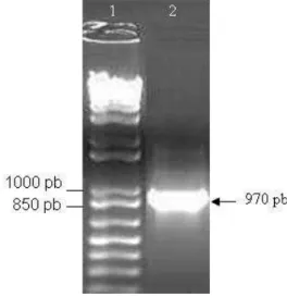 Figura 6. Gel de agarose 0,8% demonstrando a amplificação do gene wbkC . 