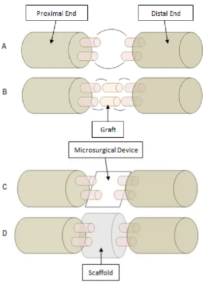 Figure 8 – Nerve repair strategies: (A) Coaptation of proximal and distal ends of damaged  axons; (B) Autograft or allograft connects proximal and distal ends; (C) Microsurgical devices  promotes axonal cutting (by using a nanoknife or a microbeam laser, a