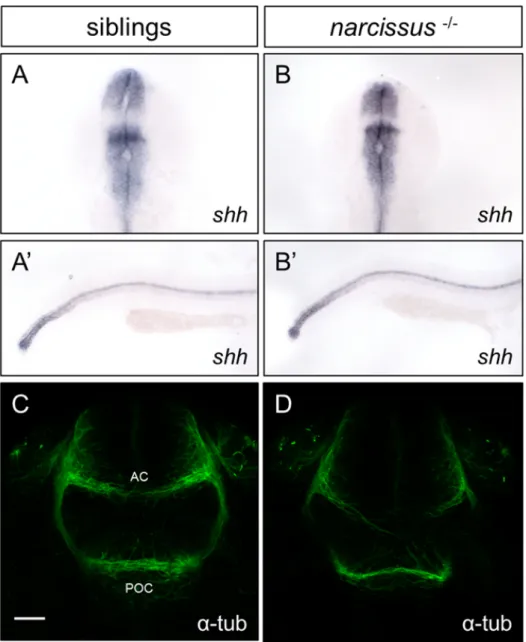 Figure 3.2: nss mutants have normal midline tissues development but display defects in commissure formation