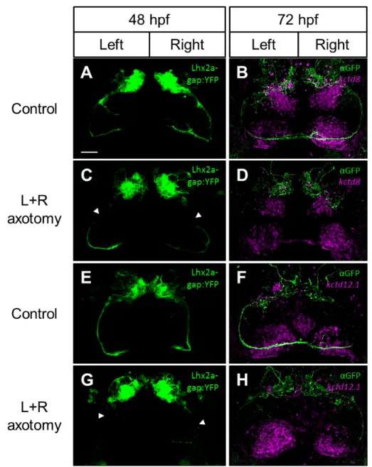 Figure 3.4: Asymmetric afferent projections from the OB in Tg(lhx2a:gap-YFP) are not required to specify dHbM neurons