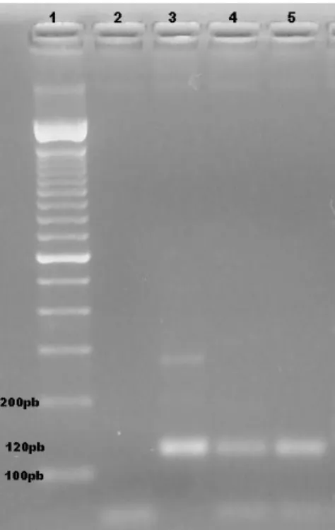 Figura 2. Resultado da PCR para o gênero Leishmania sp. utilizando-se os oligonucleotídeos LFW  e LBW1 e 2