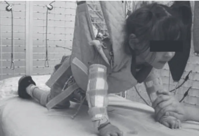 Figure 3  - Patient using the tracking rail in the monkey cage Source: Research data.