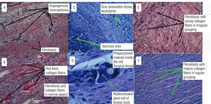 Figure 4  - A) The results of the Tsai technique (6-strands), displaying granulated tissue and angiogenesis on the 15 th  day  (100x)