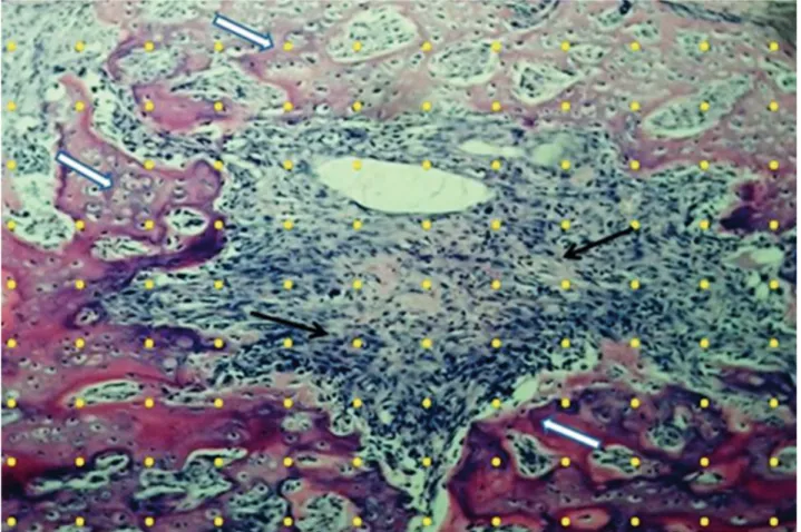 Figure 1  - Test-system with 132-points (yellow points) superimposed at a histological section from the fracture trace, used to  quantify the newly formed bone (white arrows) in the four groups of rats 