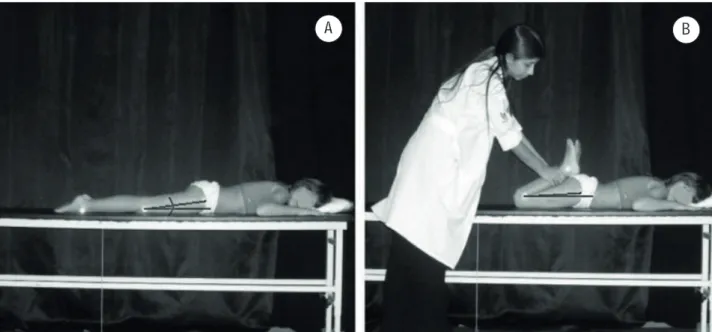 Figure 4  - Duncan-Ely test. A: initial position; B: final position