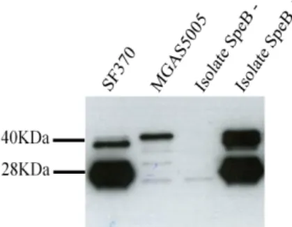 Figure  2.  Representative  Western  blot  result  for  detection  of  mature  SpeB  (28  kDa)  expression by GAS isolates