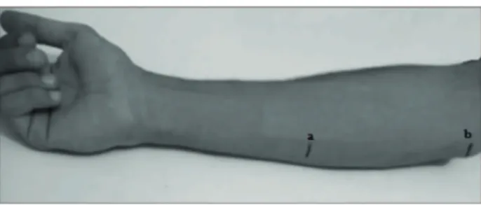 Figure 2  - Variation in mean grip strength in the different  assessments.