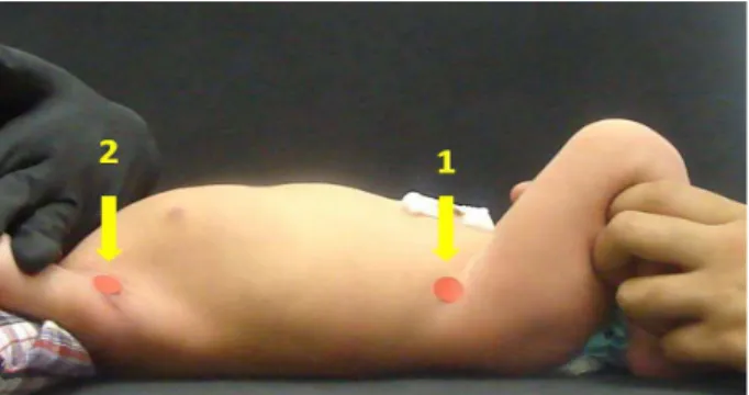 Figure 1  - Newborn positioning during the experiment and  indication of the markers for delimitation of  thoracoabdomi-nal compartment, where: (1) anterior superior iliac spines  and (2) level of the jugular notch of the sternal manubrium,  projected late