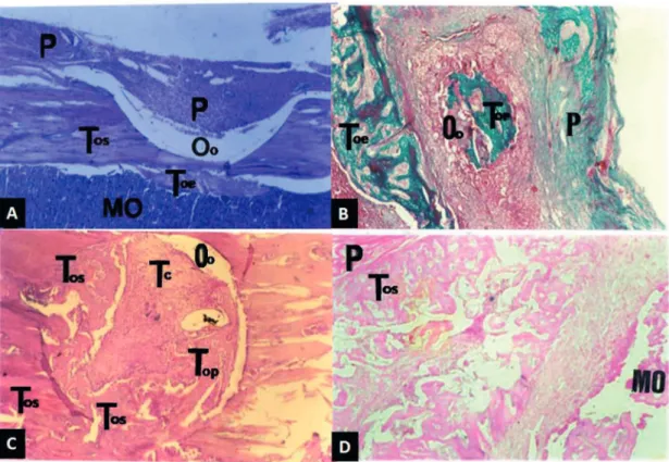 Figure 2  - Electrically stimulated group. A. Longitudinal section of middle third diaphysis of the rat subjected to osteotomy,  followed by electrical stimulation (5 days)