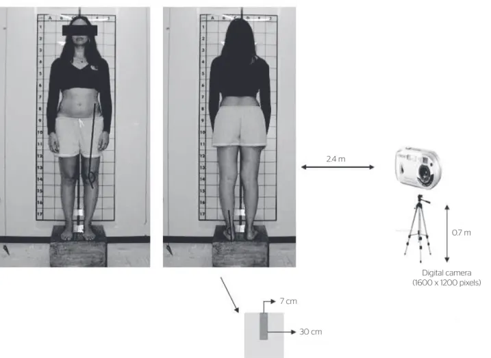 Figure 1. Data collection setup for rearfoot and Q angles