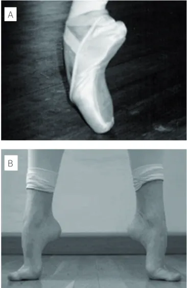 Figure 1. (A) En pointe position. (B) En demi-point position.