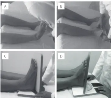 Figure 2. Inversion ande version measure of the ankle with universal  goniometer (A and B) and with podalic arthrometer (C and D)