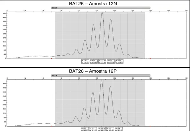 Figura 8. Eletroferogramas mostrando os alelos obtidos pelo marcador BAT 26 da  participante  de  número  12  (N  e  P)