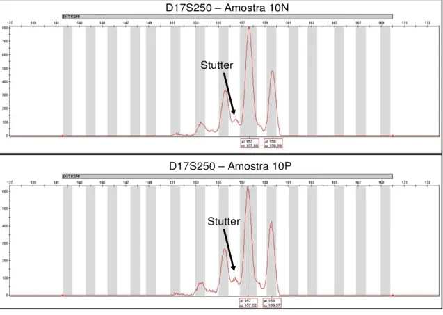 Figura  10.  Artefatos  de  amplificação  do  tipo  “stutter”  (setas),  obtidos  pelo  marcador D17S250[Mfd15CA], da participante de número 10 (N e P)