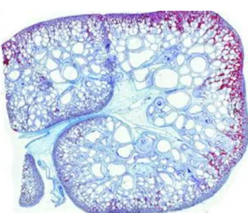 Figura  5-  Secção  histológica  de  um  rim  pertencente  a  um  feto  com 22 semanas de gestação com a forma antenatal de SBB