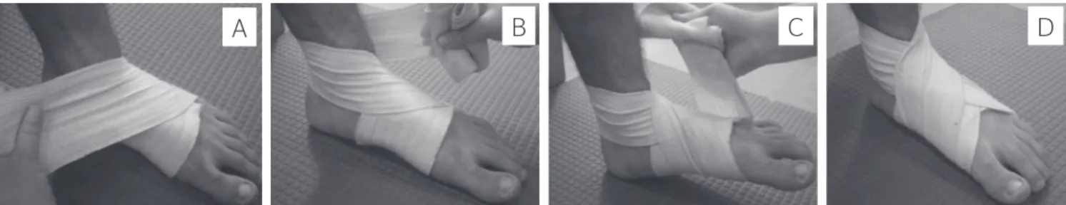 Figure 1. (A) beginning of the eight-point binding in the plantar arch. (B) Beginning the eight-point binding behind the ankle