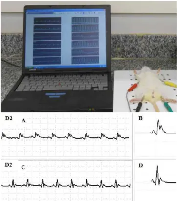 Figure 1. Representation of the HeartWare ®  system to obtain the  ECG and electrocardiographic signals obtained from derivation  DII