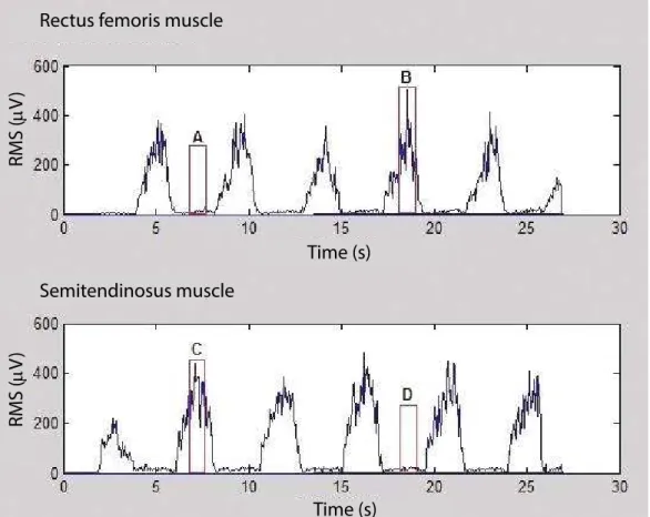 Figure 1. Title: RMS signal of rectus femoris and semitendinosus muscles. Caption: (A) Selection of rectus femoris muscle acting as an  antagonist; (B) Selection of rectus femoris muscle acting as an agonist; (C) Selection of semitendinosus muscle acting a