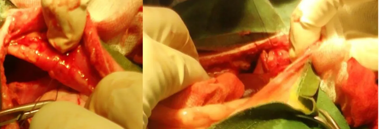 Fig.  V e VII Vista ventrocaudal direita intra-cirúrgica da parte costal do diafragma lacerado (esquerda) e a  encerramento da cavidade torácica padrão contínuo na parte costal do diafragma (direita) 