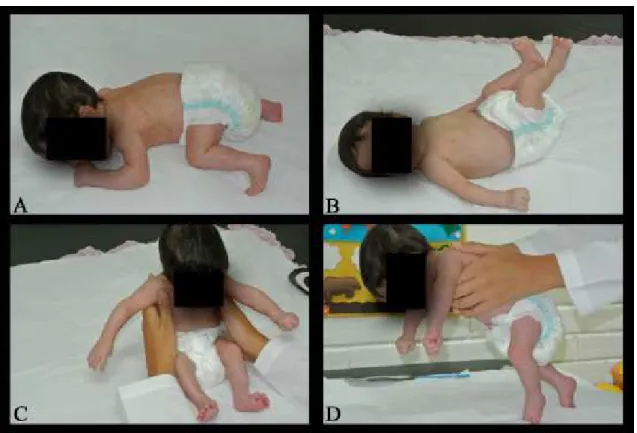 Figure 1. Positions evaluated with the Alberta Infant Motor Scale. (A) Prone. (B) Supine