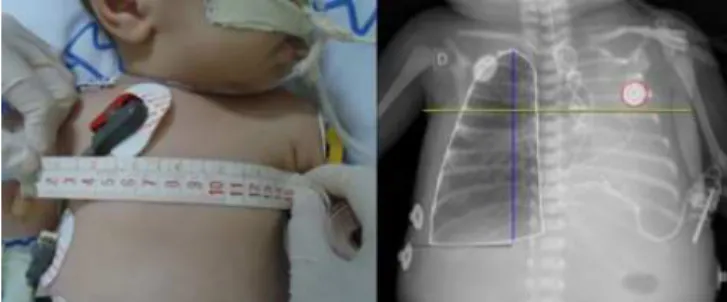 Figure 1. Analysis of the lung area with the AutoCad® 2012  program