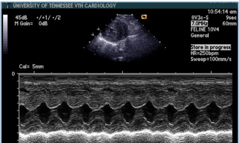Figura 1  Ecocardiografia em Modo Bi-dimensional, revelando uma  ligeira  a  moderada  hipertrofia  concêntrica  ventricular  esquerda  e  um  aumento  da  fração  de  encurtamento  no  ventrículo  esquerdo  (imagens  gentilmente  cedidas  por  Dra