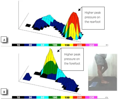Figure 5 shows an example of comparison between a  paretic foot with that of a healthy individual