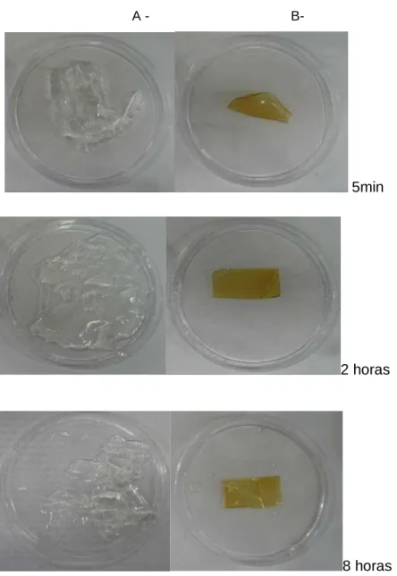 FIGURA 5.2. Fotografia das amostras após inserção no líquido de liberação  nos tempos 5  minutos, 2 e 8 horas:  A- não reticuladas  B- reticuladas