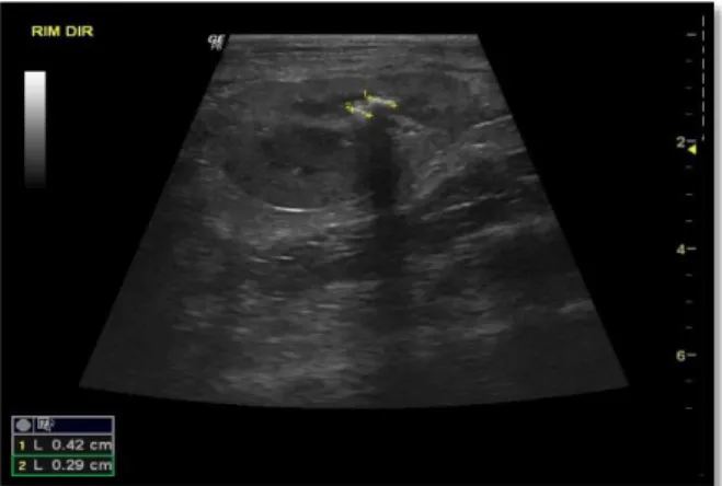 Figura  8:  Radiografia  abdominal  Bexiga  distendida  e  perda de definição do abdómen nas regiões proximais  ao  rim  e  retroperitoneais  (imagem  gentilmente  cedida  pelo ANIMED- Hospital Veterinário de Gondomar)