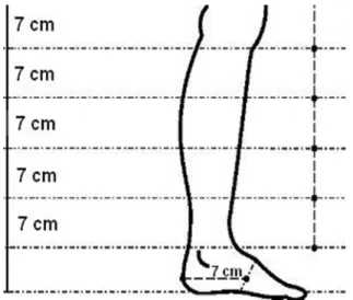 Figure 1. Schematization of the points measured in the assessment  of the circumference of the lower limb through perimetry