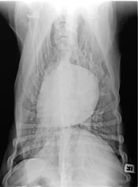 Figura 2 e 3- Imagem radiográfica torácica na projecção LL direita e dorsoventral.  Visualização de cardiomegalia e  presença de padrão intersticial pulmonar e alveolar