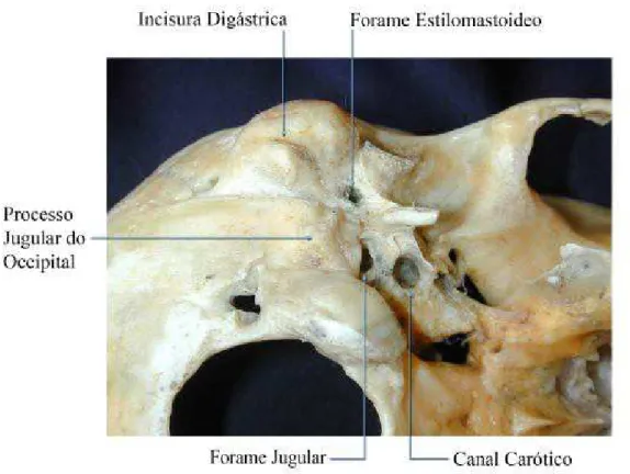 FIGURA 3 – Forame jugular na superfície inferior e lateral do crânio, à direita. 