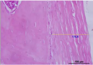 Figure 1. Sagittal section of the vertebral segment with  presentation of vertebral bodies and spinal cord