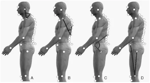 Figure 1. Angular measure of the curvatures of the vertebral column: A) Angular measure  of cervical lordosis; B) angular measure of thoracic kyphosis; C) angular measure of lumbar  lordosis; D) angular measure of pelvic position.