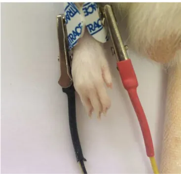 Figure 1. Electrodes placed on the medial and lateral aspects of  the ankle joint.