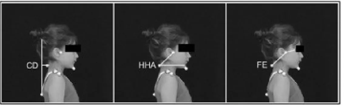 Table 1 – Craniocervical posture measures comparison between  G1 and G2