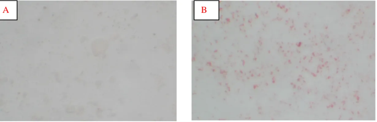Figura 3 - Fotomicrografia de preparação negativa (A) e positiva, 1:60, (B) à sorologia utilizando  a técnica de imunoperoxidase em lâminas para detecção de anticorpos contra L