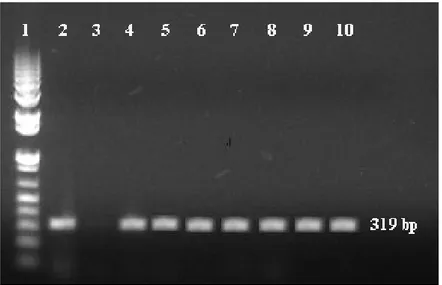 Figura 4 - Eletroforese em gel da agarose de produto da amplificação para L. intracellularis em  amostras  de  fezes  de  potros