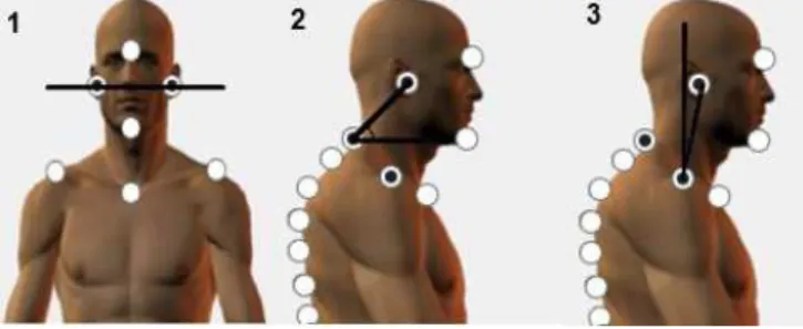Figure 1. (1) Horizontal head alignment in anterior view  (HHA_A); (2); head horizontal alignment in lateral view  (HHA_L); (3) Vertical head alignment in the lateral view  (VHA_L)