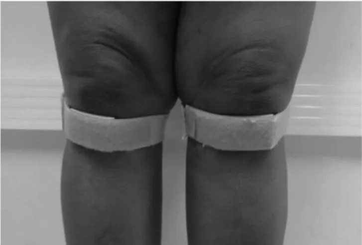 Figura 1. Bandagem infrapatelar.