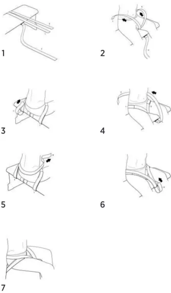 Figura 2. Demonstração da colocação do enfaixamento para  posicionamento do paciente.1573 6 24