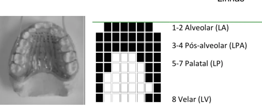 FIGURA 2 - Palato artificial apresentando 62 eletrodos. À direita, o palatograma  do  fone [t], discriminando-se as regiões articulatórias de possível contato da língua com  o  palato,  sendo  que  os  quadros  em  preto  referem-se  aos  contatos  realiza