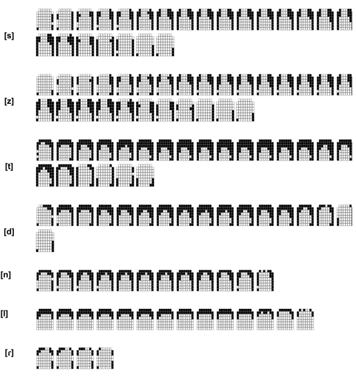 FIGURA  5  –  Sequência  de  palatogramas,  a  cada  10  ms,  mostrando  contatos  da  língua  com  o  palato  para  os  fones  alveolares,  do  início  ao  final  da  produção,  respectivamente,  nas  palavras:  massada,  casada,  batata,  fadada,  sanada