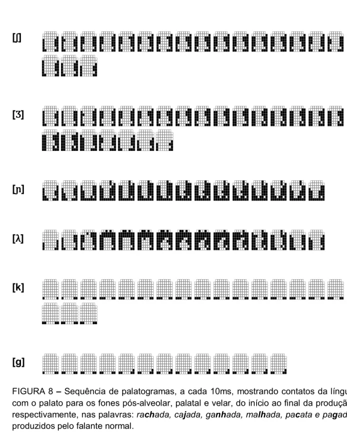 FIGURA 8 – Sequência de palatogramas, a cada 10ms,  mostrando contatos da língua  com o palato para os fones pós-alveolar, palatal e velar, do início ao final da produção, respectivamente, nas palavras: rachada, cajada, ganhada, malhada, pacata e pagada,  