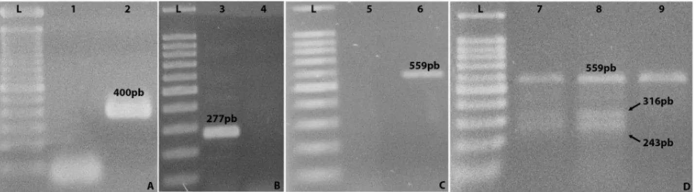 Figura 1. Eletroforese em gel de agarose corado com brometo de etídio 0,01% dos resultados dos controles  positivos  das  PCRs  realizadas  (A:  PCR  GAPDH,  B:  PCR  PKD-F3/R2,  C:  PCR  PKD1,  D:  RFLP-PCR  utilizando a enzima MLY1)