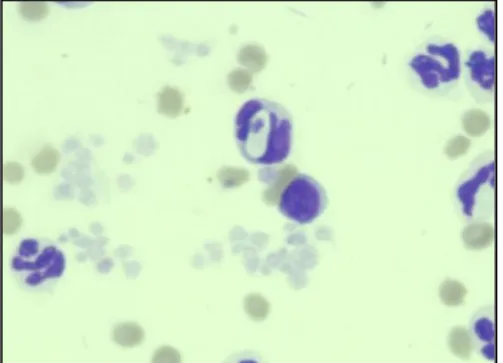Figura  2.  Gametócito  do  Hepatozoon  canis  encontrado  em  neutrófilo  durante  examinação  do  esfregaço sanguíneo