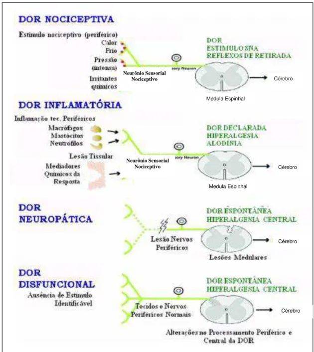 Figura 1 - Classificação dos tipos de dor (figura adaptada de Clifford &amp; Woolf, 2004).Neurônio Sensorial Nociceptivo Neurônio Sensorial Nociceptivo Cérebro Cérebro Cérebro Cérebro Medula Espinhal Medula Espinhal 