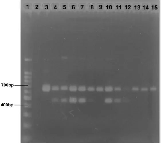 Figura  7:  Resultado  de  PCR  para  sexagem  das  aves.  1  -  Marcador  de  peso  molecular  (100bp 15 ); 2 - Controle negativo (água miliQ); 3, 9, 13, 14, e 15 - Aves machos (ZZ); 4, 5, 6,  7, 8, 10, 11, e 12 - Aves fêmeas (ZW)