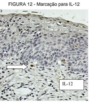 FIGURA 12 - Marcação para IL-12 