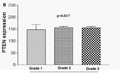 Figure 3: Association between PTEN expression and p53 (A), CD31(B) and Ki- Ki-67 (C) tumor expression in patients with squamous cell carcinoma of the cervix